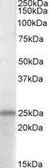 Anti-PACAP antibody, C-term used in Western Blot (WB). GTX88313