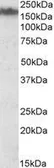 Anti-NF-M antibody, Internal used in Western Blot (WB). GTX88324