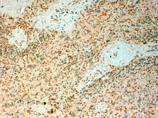 Anti-TET2 antibody, Internal used in IHC (Paraffin sections) (IHC-P). GTX88329