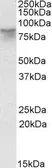 Anti-AFM antibody, Internal used in Western Blot (WB). GTX88333