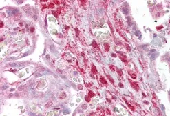 Anti-Calponin 2 antibody, Internal used in IHC (Paraffin sections) (IHC-P). GTX88377