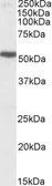 Anti-5-HT3B receptor antibody, Internal (near C-terminus) used in Western Blot (WB). GTX88391