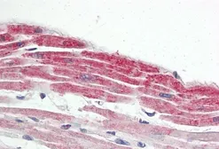 Anti-Nkx2.5 antibody, Internal used in IHC (Paraffin sections) (IHC-P). GTX88402