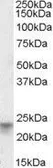Anti-TM4SF3 / TSPAN8 antibody, Internal used in Western Blot (WB). GTX88421