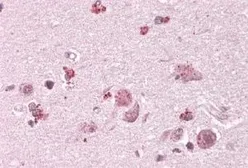 Anti-CHN2 antibody, C-term used in IHC (Paraffin sections) (IHC-P). GTX88448