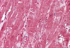 Anti-CSRP3 antibody, Internal used in IHC (Paraffin sections) (IHC-P). GTX88505