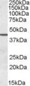 Anti-Septin 2 antibody, N-term used in Western Blot (WB). GTX88523