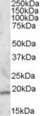 Anti-RGS13 antibody, N-term used in Western Blot (WB). GTX88537