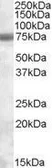 Anti-EXOSC9 antibody, C-term used in Western Blot (WB). GTX88547