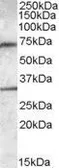 Anti-Endothelial Lipase / LIPG antibody, Internal used in Western Blot (WB). GTX88568