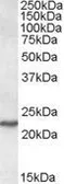 Anti-SAR1A antibody, Internal used in Western Blot (WB). GTX88575