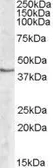 Anti-SPHK1 antibody, Internal used in Western Blot (WB). GTX88593