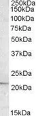 Anti-APOBEC3C antibody, C-term used in Western Blot (WB). GTX88604