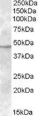 Anti-TMPRSS4 antibody, Internal used in Western Blot (WB). GTX88636