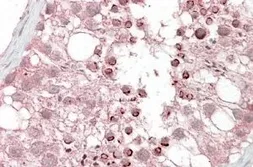 Anti-USP28 antibody, Internal used in IHC (Paraffin sections) (IHC-P). GTX88638