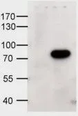 Anti-ABCD1 antibody, Internal used in Western Blot (WB). GTX88645