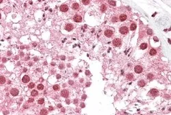 Anti-MSH5 antibody, Internal used in IHC (Paraffin sections) (IHC-P). GTX88660