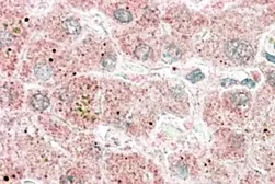 Anti-Apolipoprotein F antibody, C-term used in IHC (Paraffin sections) (IHC-P). GTX88675