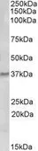 Anti-GCH1 antibody, Internal used in Western Blot (WB). GTX88689
