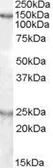 Anti-mKIAA0319 antibody, Internal used in Western Blot (WB). GTX88729