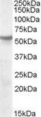 Anti-AChR beta 1 antibody, Internal used in Western Blot (WB). GTX88771