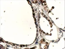 Anti-DUOX1 antibody, Internal used in IHC (Paraffin sections) (IHC-P). GTX88773