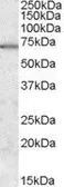 Anti-MARK2 antibody, Internal used in Western Blot (WB). GTX88790
