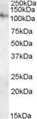 Anti-ATP13A1 antibody, Internal used in Western Blot (WB). GTX88817
