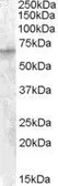 Anti-IGF2BP2 antibody, C-term used in Western Blot (WB). GTX88840
