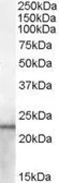 Anti-Lipocalin-2 antibody, Internal used in Western Blot (WB). GTX88841