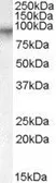 Anti-Factor XIIIa (703-717) antibody, Internal used in Western Blot (WB). GTX88886