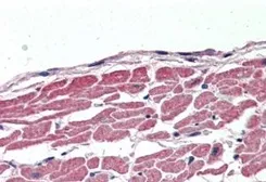 Anti-SLC12A6 antibody, Internal used in IHC (Paraffin sections) (IHC-P). GTX88947