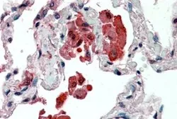 Anti-IDE antibody, Internal used in IHC (Paraffin sections) (IHC-P). GTX89007