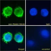 Anti-CD11b antibody, Internal used in Immunocytochemistry/ Immunofluorescence (ICC/IF). GTX89035