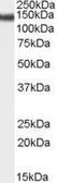 Anti-SA2 antibody, Internal used in Western Blot (WB). GTX89044