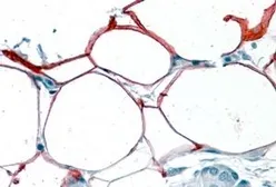 Anti-KIAA1881 antibody, Internal used in IHC (Paraffin sections) (IHC-P). GTX89103