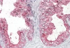 Anti-Kallikrein 2 antibody, Internal used in IHC (Paraffin sections) (IHC-P). GTX89122