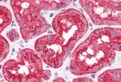 Anti-ABHD5 antibody, Internal used in IHC (Paraffin sections) (IHC-P). GTX89147