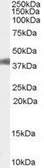 Anti-AGTR1 antibody, Internal used in Western Blot (WB). GTX89149