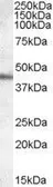 Anti-Apolipoprotein A4 antibody, Internal used in Western Blot (WB). GTX89166