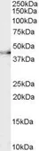 Anti-CNTFR alpha antibody, Internal used in Western Blot (WB). GTX89185