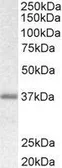 Anti-Biglycan Preproprotein antibody, C-term used in Western Blot (WB). GTX89194