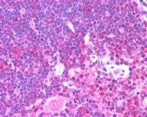Anti-Munc 13-4 antibody, Internal used in IHC (Paraffin sections) (IHC-P). GTX89269