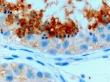 Anti-GPX4 (Isoform a and c) antibody, C-term used in IHC (Paraffin sections) (IHC-P). GTX89281