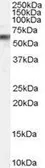Anti-VPS45 antibody, C-term used in Western Blot (WB). GTX89286