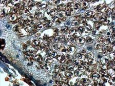 Anti-SLIT2 antibody, Internal used in IHC (Paraffin sections) (IHC-P). GTX89329