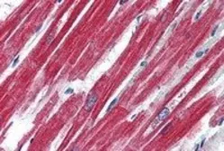 Anti-Leptin Receptor antibody, Internal used in IHC (Paraffin sections) (IHC-P). GTX89338