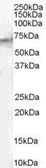 Anti-STAM2 antibody, Internal used in Western Blot (WB). GTX89357