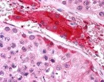 Anti-HGS antibody, Internal used in IHC (Paraffin sections) (IHC-P). GTX89364