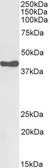 Anti-HSD3B1 antibody, C-term used in Western Blot (WB). GTX89377